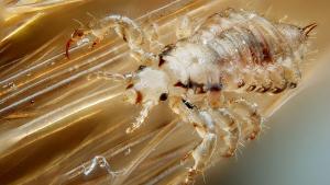 Headlice