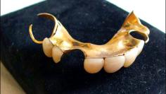 Winston Churchill’s Denture: $23,700