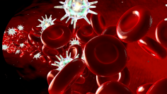 leukemia cells