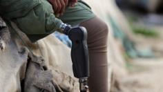 Mutassim al-Misrati, a Benghazi-local who lost his leg during a three-year war in the city, smokes a cigarette as he sits at Benghazi port